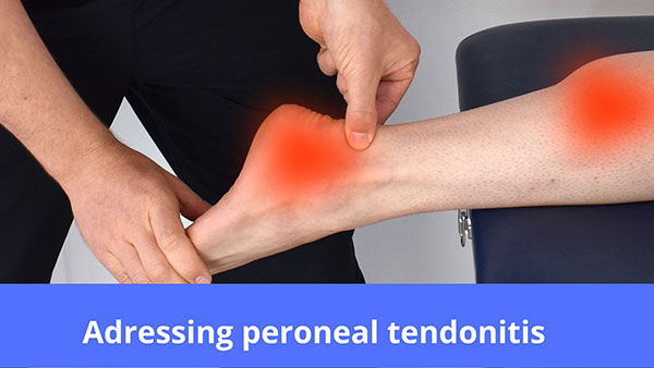 Can Shoes Cause Peroneal Tendonitis